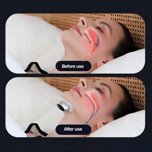 Anti Snoring Device with Patches Electric - Image 3